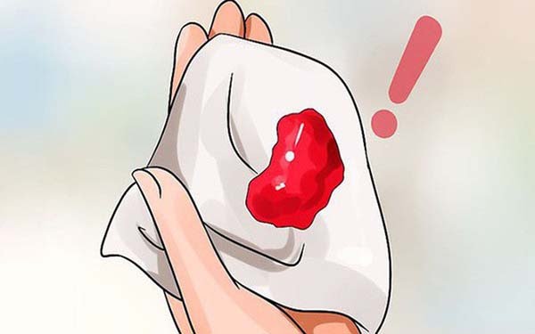  Phụ nữ ra máu sau khi quan hệ nhưng không đau có sao không?