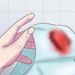 Phụ nữ ra máu sau khi quan hệ nhưng không đau có sao không?