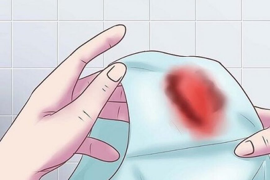 Phụ nữ ra máu sau khi quan hệ nhưng không đau có sao không?